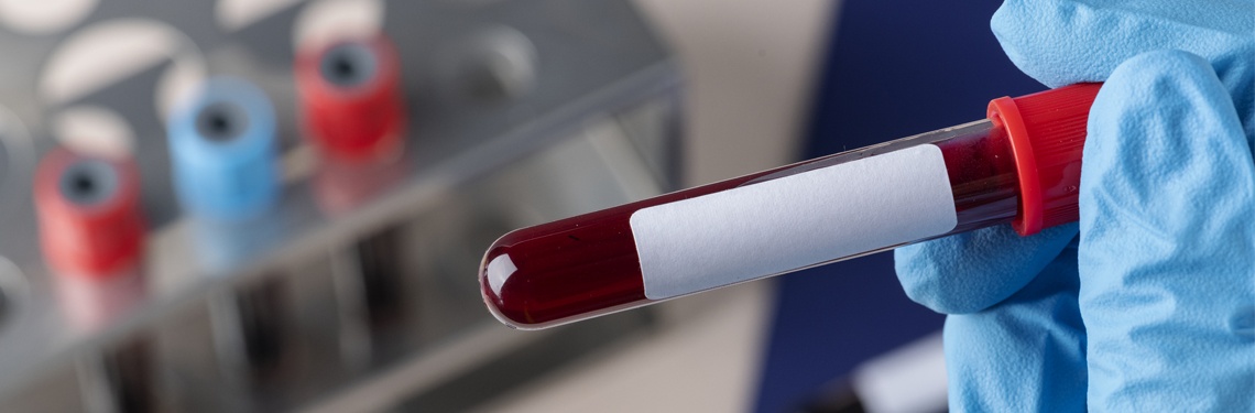 Сдача крови для анализов, как правильно совершать и необходимо знать
